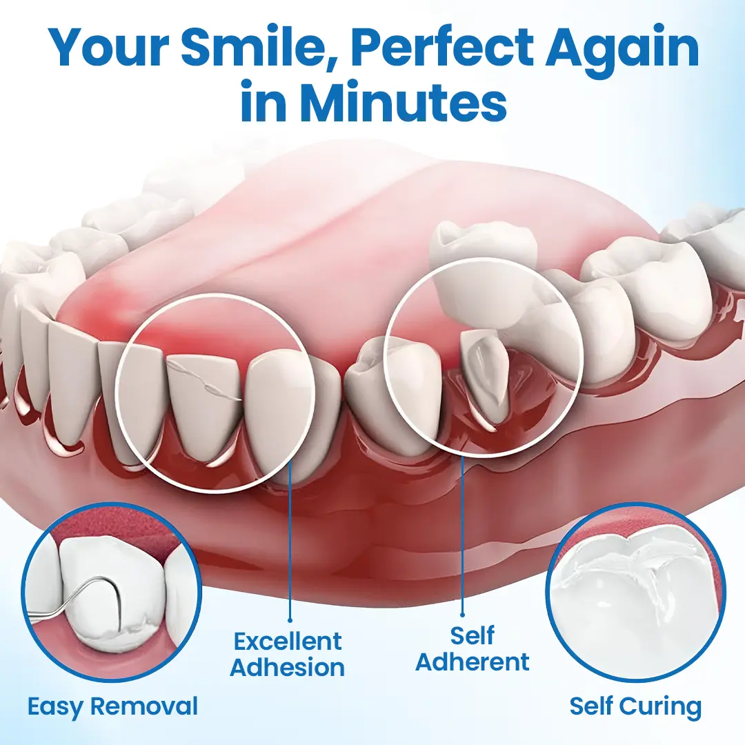 Tooth Repair Filling Kit - Image 9
