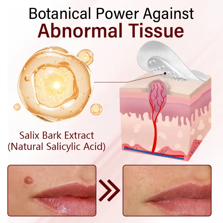 Vionara Nano WartErase Patch - Image 4