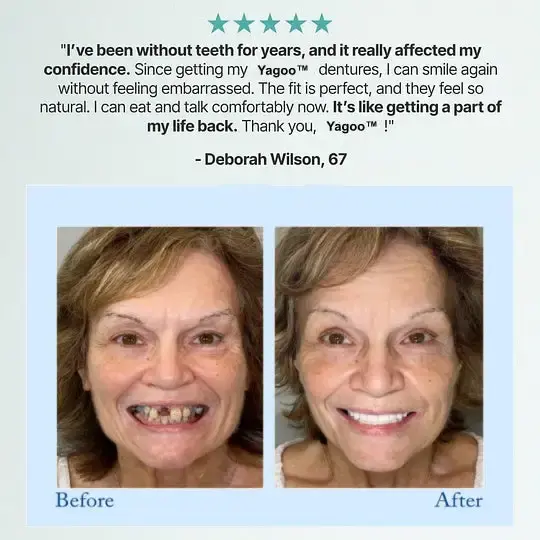 🦷Advanced Customized Full Denture Set🦷 (🔥10,000+ Sold In Last 30 Day) - Image 2