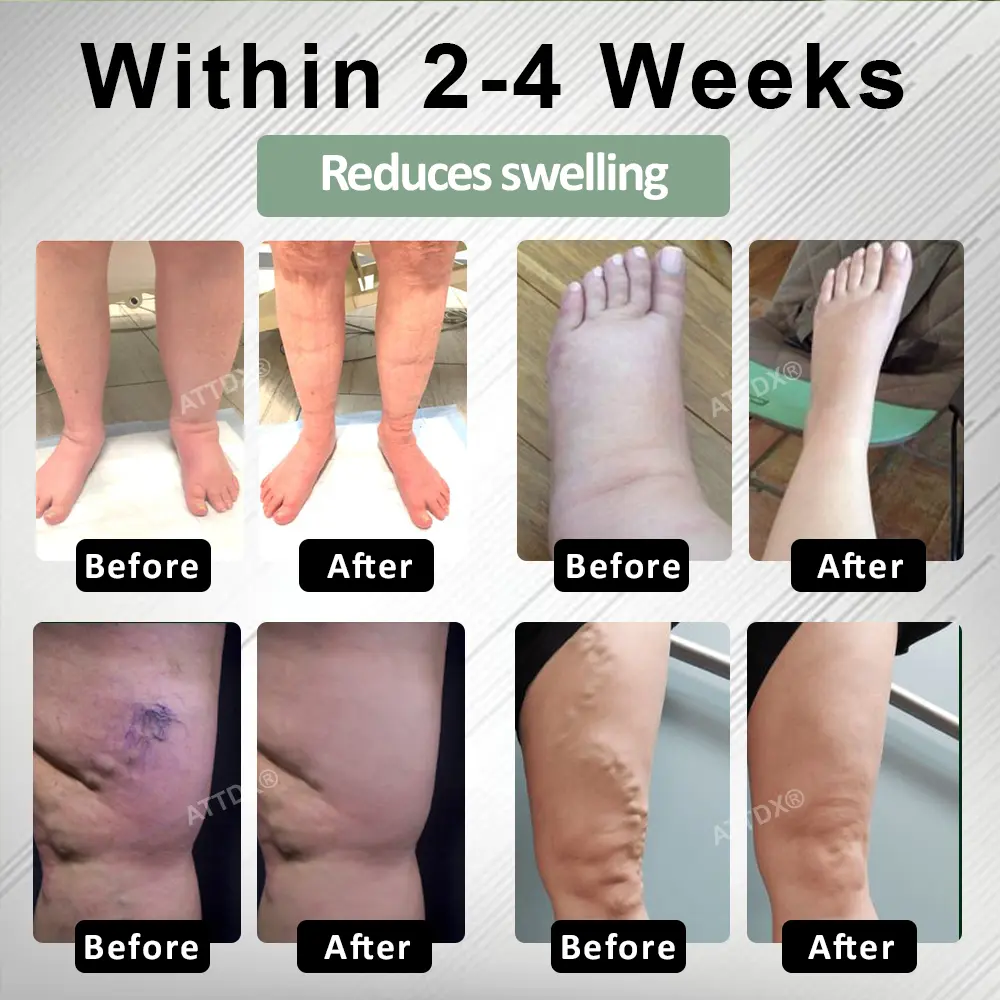 FlowBoost Edema Drain Herbal Roll On - Image 5