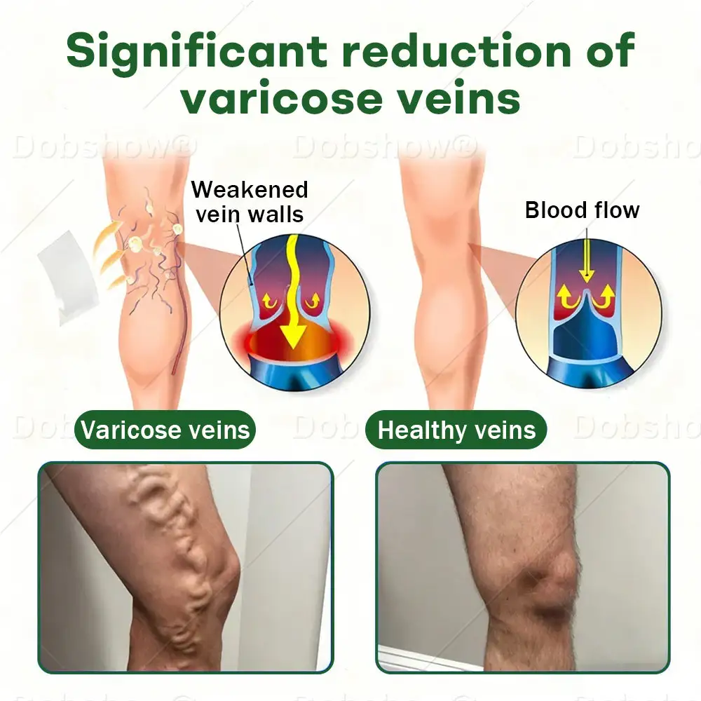 VeinLock Microneedle Patch - Image 6