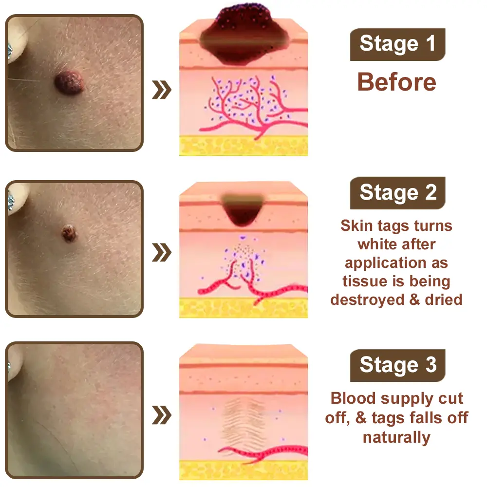 KeraErase Dual-Effect Renewal Cream - Image 11