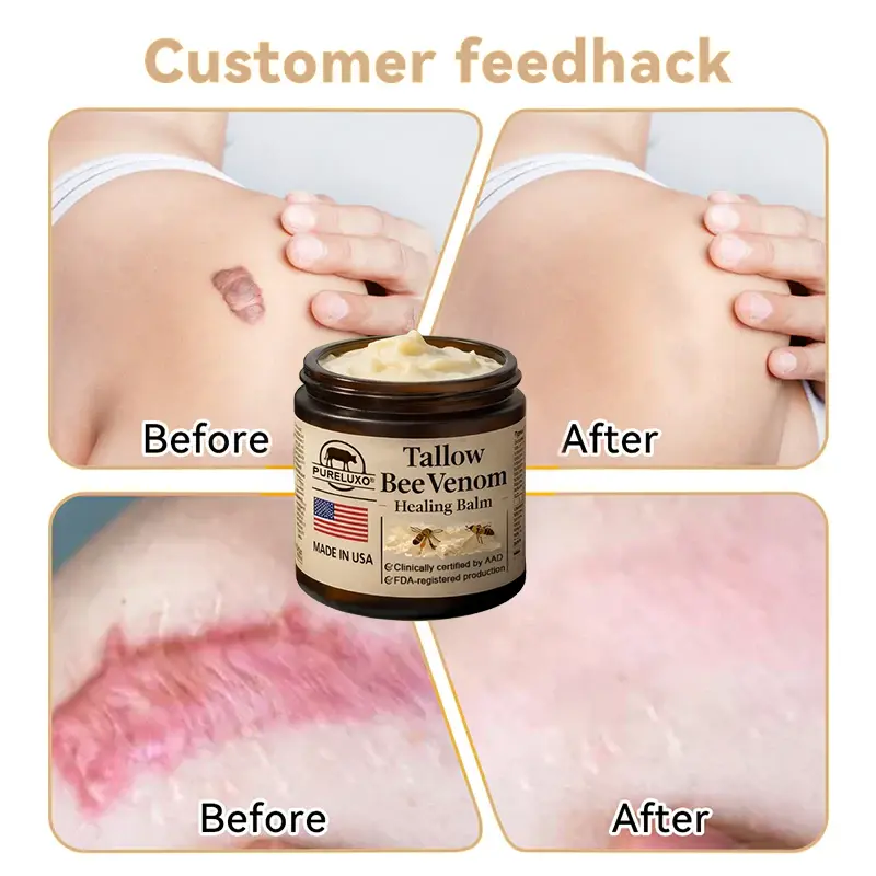 Tallow Bee Venom Healing Balm - Image 11