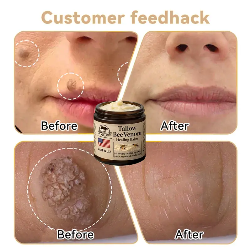 Tallow Bee Venom Healing Balm - Image 10