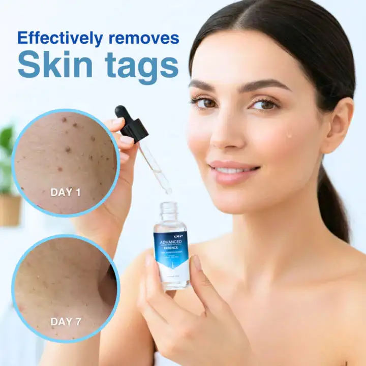 Advanced Skin Tag & Wart Removal Essence - Image 6