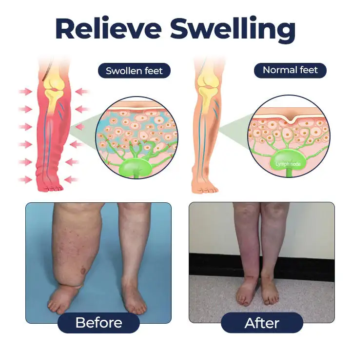 SwellRelief Circulation Support Cream - Image 6