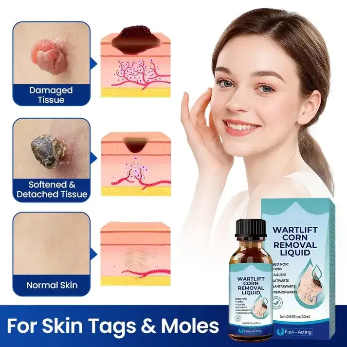 Wart Lift Wart Removal Liquid - Image 5