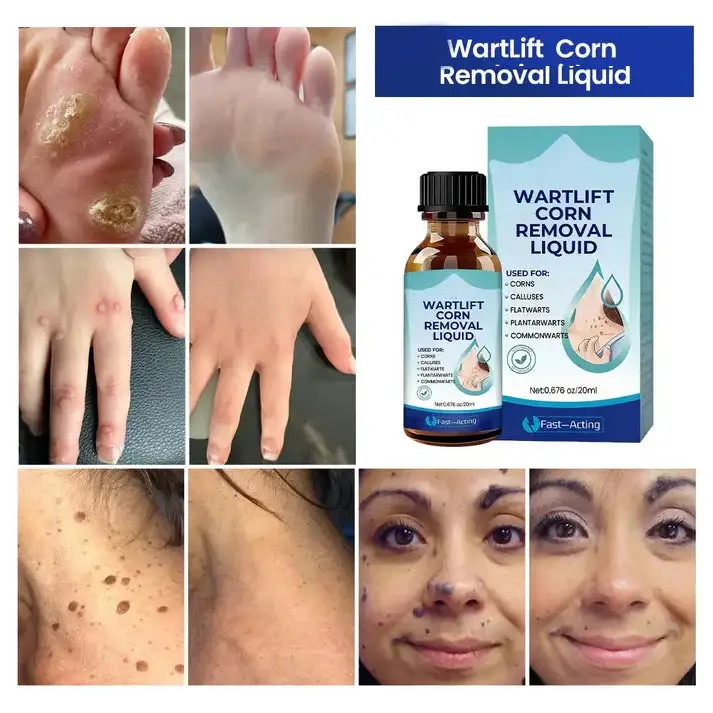 Wart Lift Wart Removal Liquid - Image 6