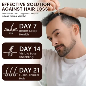 Alternative view of FollicaBoost 5% Minoxidil Hair Care Oil