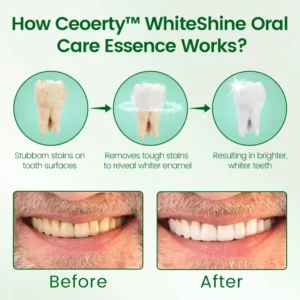 Alternative view of WhiteShine Oral Care Essence
