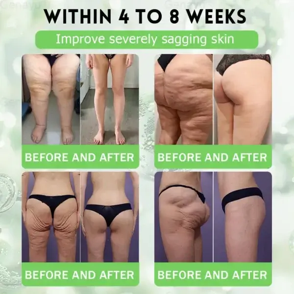 ️ MORINGA+BERBERINE Advenaced Nano Microneedle Patch - Image 5