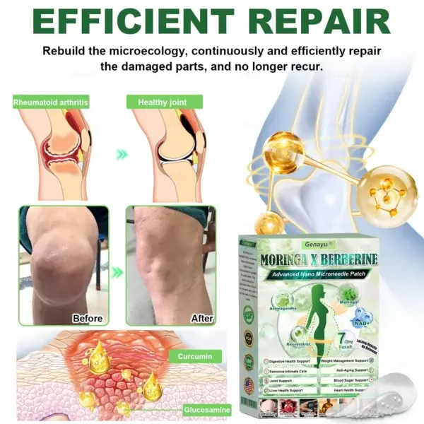 ️ MORINGA+BERBERINE Advenaced Nano Microneedle Patch - Image 9