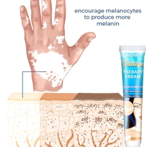 Alternative view of Vitiligo Therapy Cream
