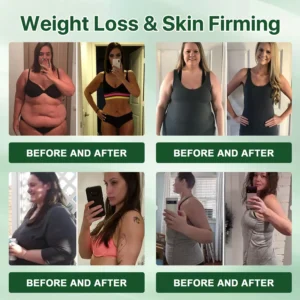 Alternative view of Official Store | Moringa Berberine + NAD+ 10-in-1 Nano Microneedle Patch(Just once a day, visible changes in 7 days)