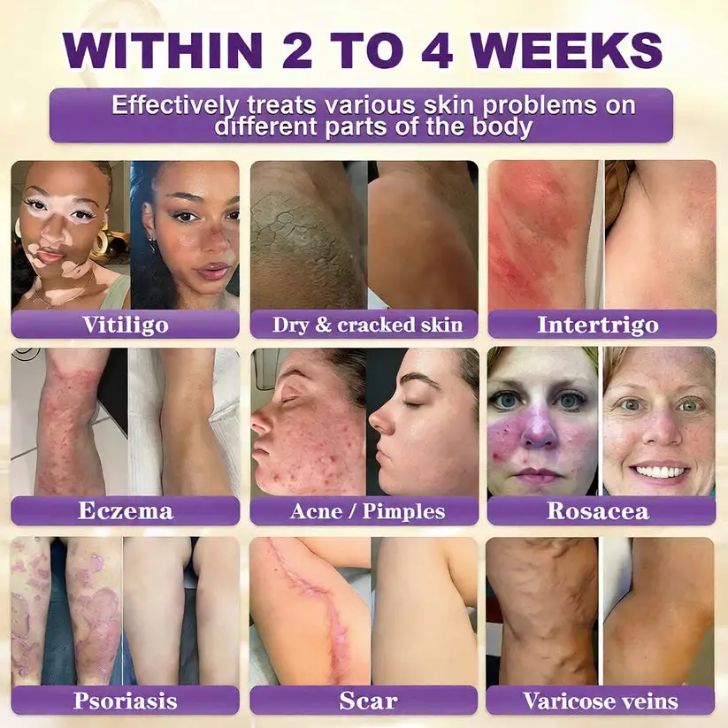 Skin Repair Cream - Image 2