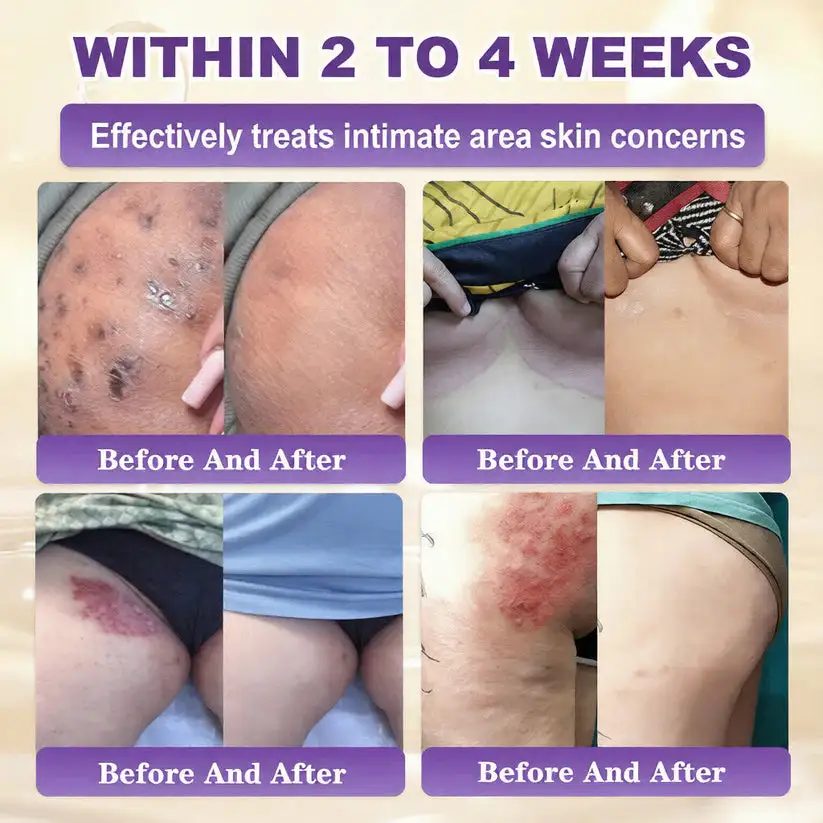 Skin Repair Cream - Image 4