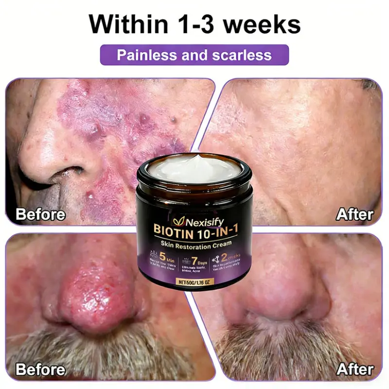 Skin Repair Cream - Image 8