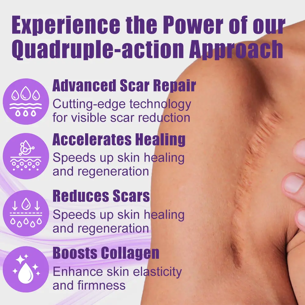 ๐ ๐ฝ๐๐บ๐๐ผ๐พ๐ฝ ๐ฒ๐ผ๐บ๐ ๐ฆ๐พ๐
- Image 10