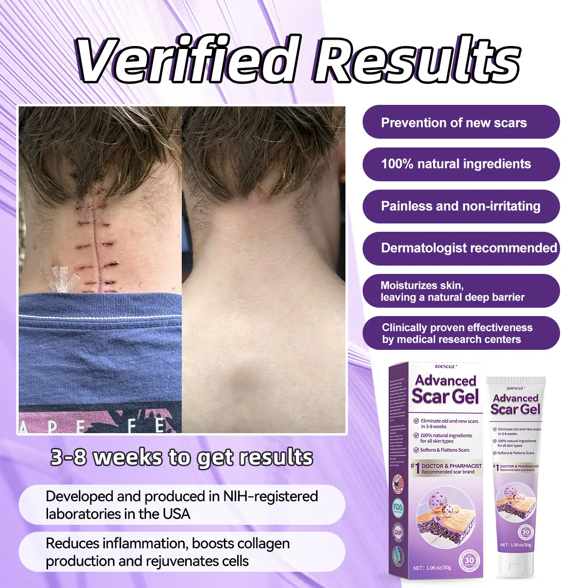 ๐ ๐ฝ๐๐บ๐๐ผ๐พ๐ฝ ๐ฒ๐ผ๐บ๐ ๐ฆ๐พ๐
- Image 2