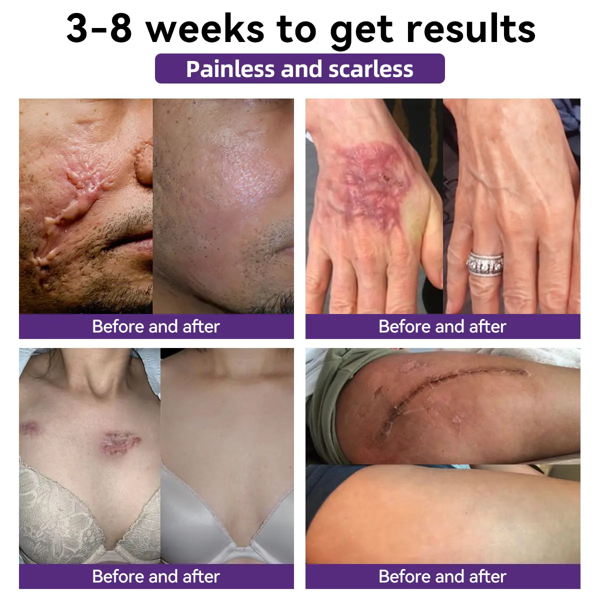 ๐ ๐ฝ๐๐บ๐๐ผ๐พ๐ฝ ๐ฒ๐ผ๐บ๐ ๐ฆ๐พ๐
- Image 3