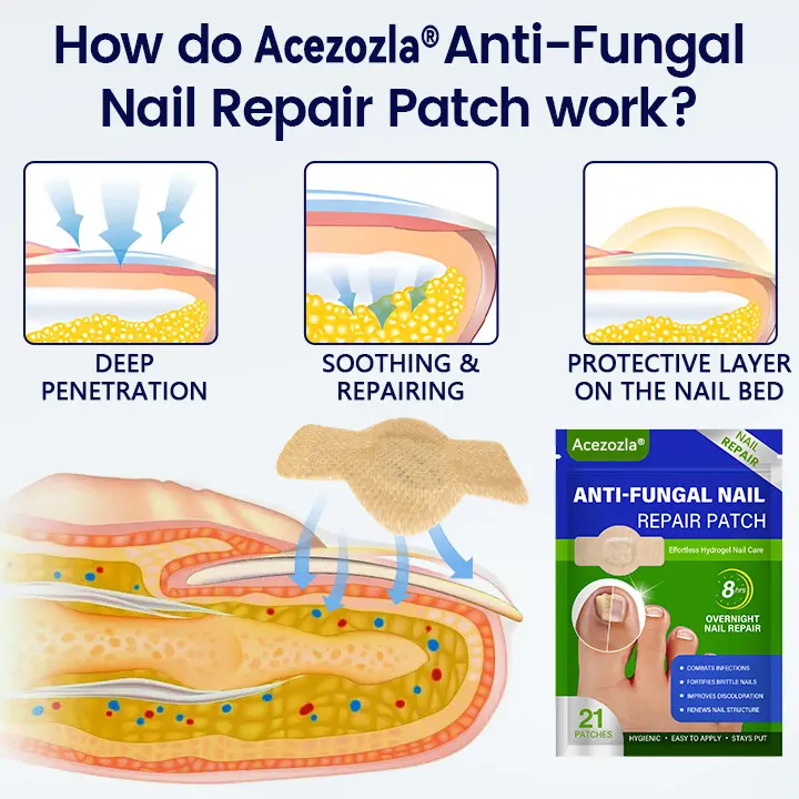 Anti-Fungal Nail Repair Patch - Image 5