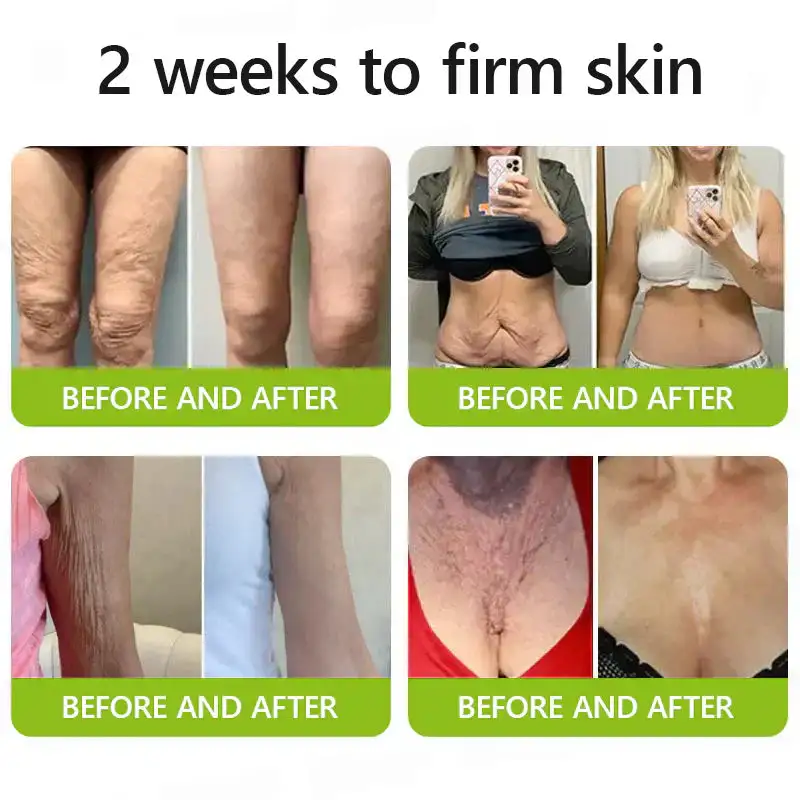 BOTOX & VITA A RETINOL SHOT Wrinkle Lift Tightening Cream - Image 13