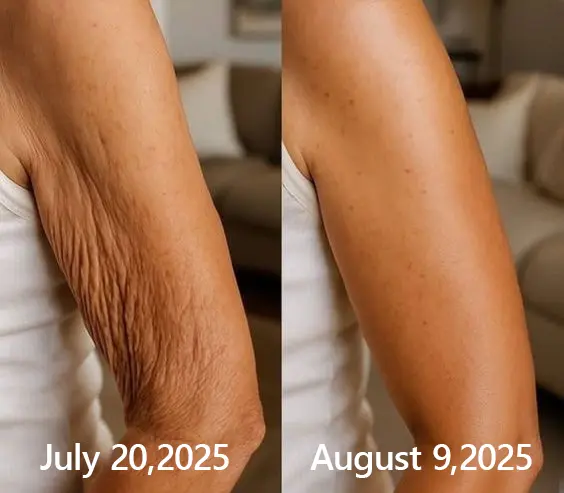 BOTOX & VITA A RETINOL SHOT Wrinkle Lift Tightening Cream - Image 53