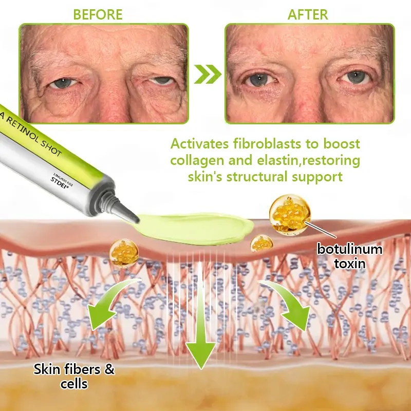 BOTOX & VITA A RETINOL SHOT Wrinkle Lift Tightening Cream - Image 62