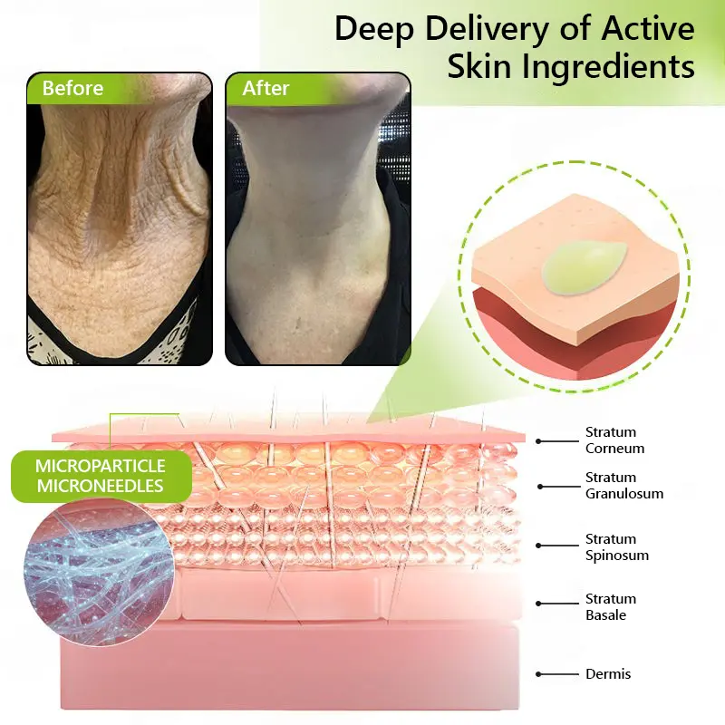 BOTOX & VITA A RETINOL SHOT Wrinkle Lift Tightening Cream - Image 63