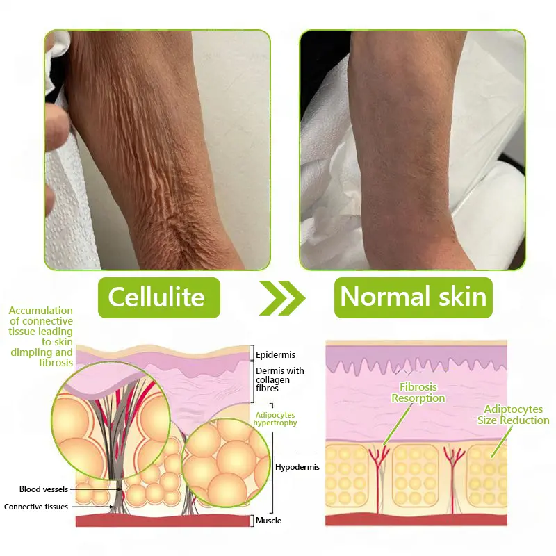 BOTOX & VITA A RETINOL SHOT Wrinkle Lift Tightening Cream - Image 64