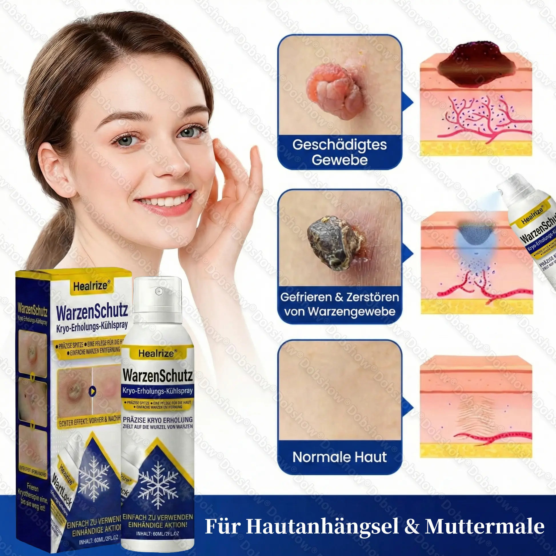 WartLock Kryo-Recovery Kühlspray🎉 Zeitlich begrenzter Sonderrabatt - Image 6