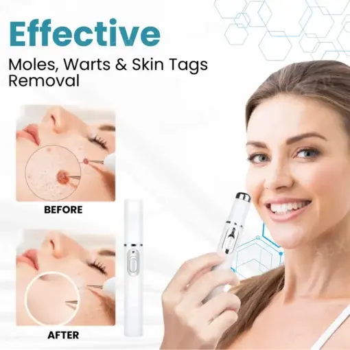Professional Non-Invasive Mole and Wart Removal Laser Pen - Image 4