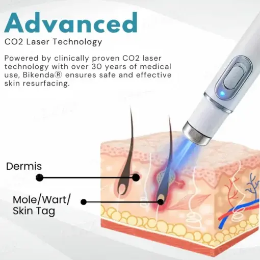 Professional Non-Invasive Mole and Wart Removal Laser Pen - Image 6