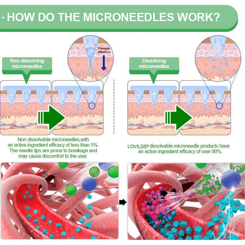 𝑩𝒆𝒓𝑏𝘦𝘳𝑖𝗇𝒆 𝟔-𝗶𝙣-𝟏 𝑁𝑎𝑛𝑜 𝘔𝘪𝘤𝘳𝘰𝘯𝘦𝘦𝘥𝘭𝘦 𝖯𝚊𝗍𝖼𝗁 |✅ 𝟨-𝗂𝗇-𝟣 𝖿𝗈𝗋𝗆𝗎𝗅𝖺 | 𝑅𝑒𝑠𝑢𝑙𝑡𝑠 𝑖𝑛 7 𝑑𝑎𝑦𝑠 🏅 - Image 5