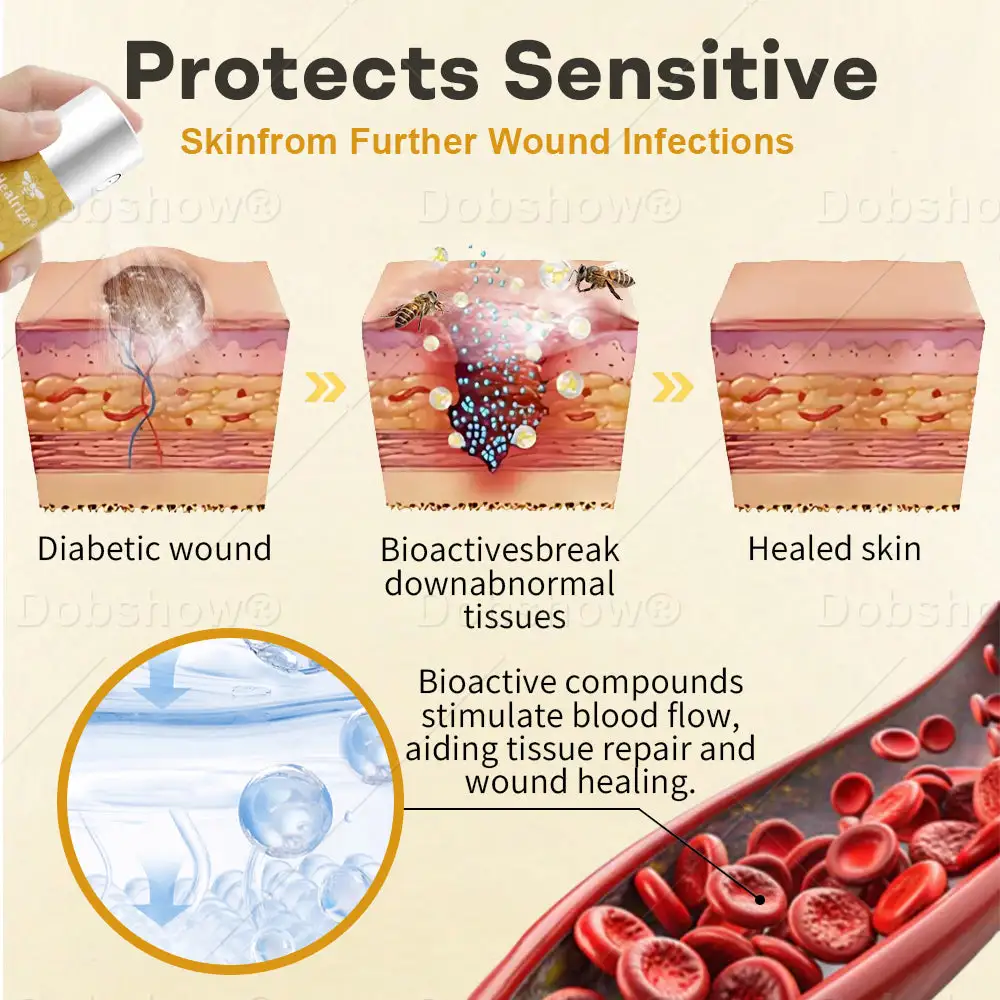 ๐ฅ ๐๐๐ข๐๐ฉ๐๐ ๐๐๐๐๐ง โ ๐๐๐ซ๐ ๐๐ค๐๐๐ฎ | GlucoShield Bee Venom Wound Spray๐ฅ#1 Best-Selling Wound Care Spray - Image 4