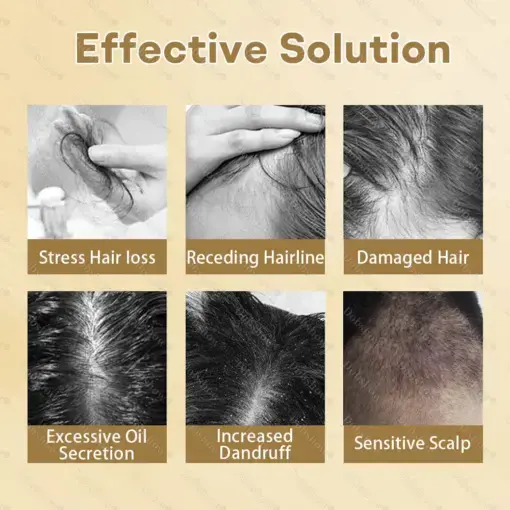 Hair Regrowth Capsules Nano Penetration, Deep into Hair Roots - Image 3