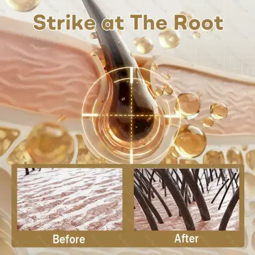 Hair Regrowth Capsules Newly Upgraded,Nano Penetration, Deep into Hair Roots - Image 6