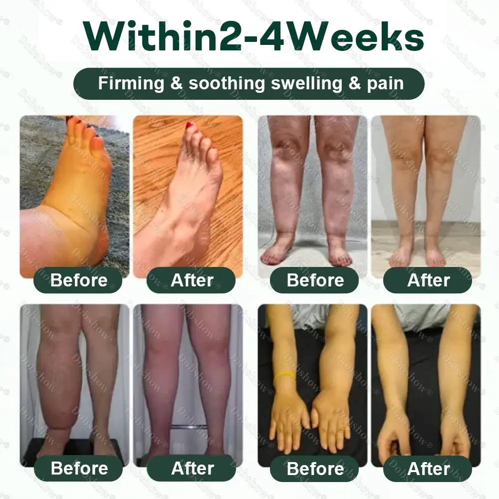 LymphDrain Herbal Soothing Cream - Image 2