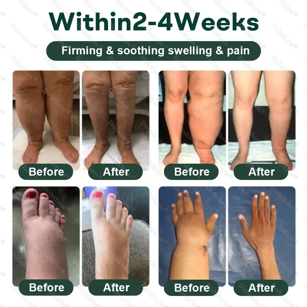 LymphDrain Herbal Soothing Cream - Image 3