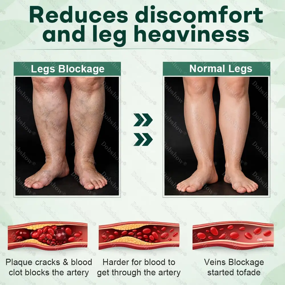 LymphDrain Herbal Soothing Cream - Image 4