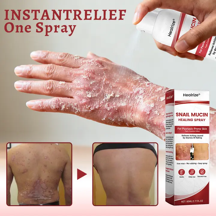 Snail Mucin Healing Spray – Relief for Sensitive & Flare-Up Skin - Image 7