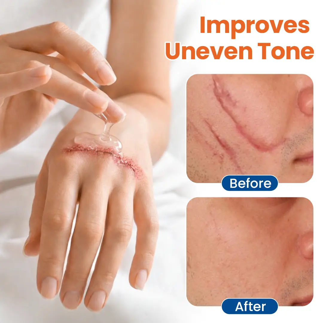 DermalRebuild Skin Renewal Gel - Image 5