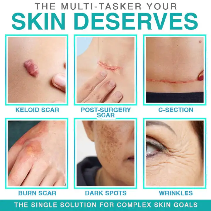 3-in-1 Microneedle Care Patch - Image 6