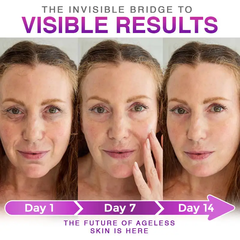 3-in-1 Microneedle Anti-Aging Patch - Image 5