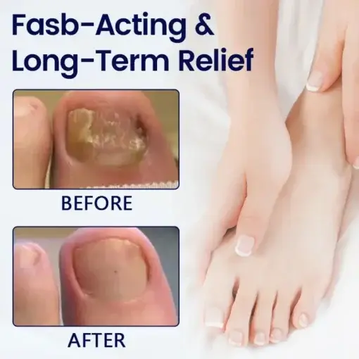 Anti-Fungal Nail Repair Patch - Image 3