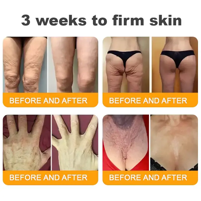 Bee Poison Skin Restoration Cream - Image 16