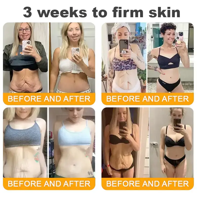 🐝Bee Poison Skin Restoration Cream 🐝 - Image 14