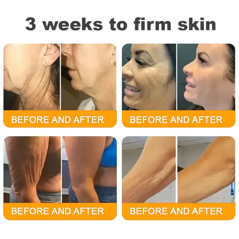 🐝Bee Poison Skin Restoration Cream 🐝 - Image 15