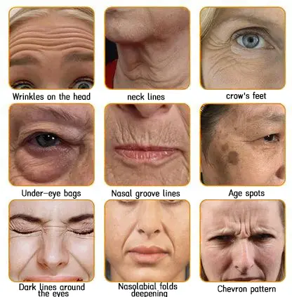 🐝Bee Poison Skin Restoration Cream 🐝 - Image 18