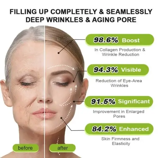 moringa Vita-A Retinol Shot Wrinkle-Lift Tightening cream – Last Day Promotion 50 OFF - Image 15